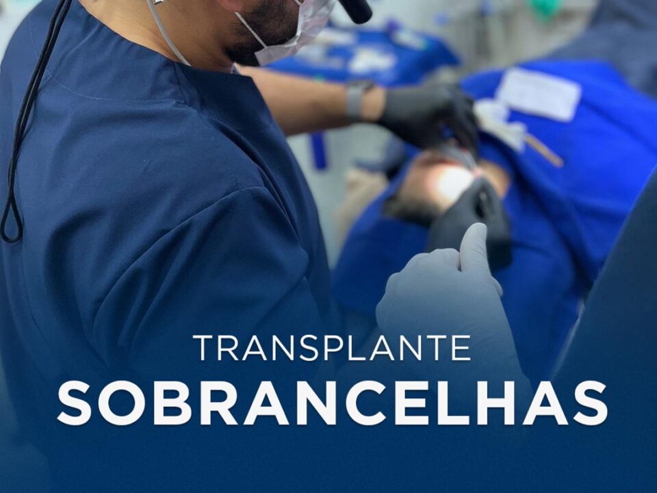 transplante de sobrancelhas em manaus